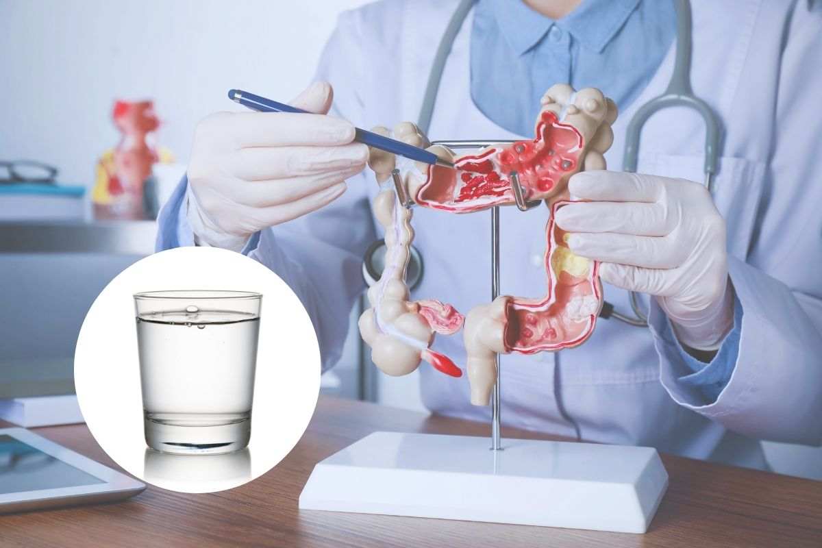 medico fa vedere l'intestino e nel cerchietto un bicchiere
